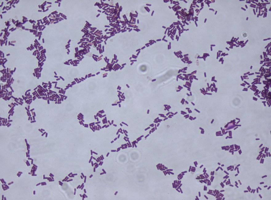 Сенная палочка (bacillus subtilis): характеристика, роль в организме человека, применение