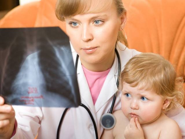 Признаки пневмонии у ребенка без температуры но с кашлем симптомы