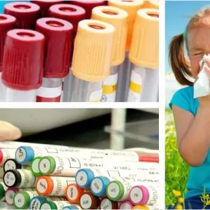 Как берут пробы на аллергены: разновидности кожных тестов, особенности проведения и результаты