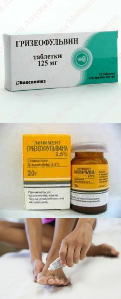 Лечение грибковых инфекций при помощи препарата гризеофульвин