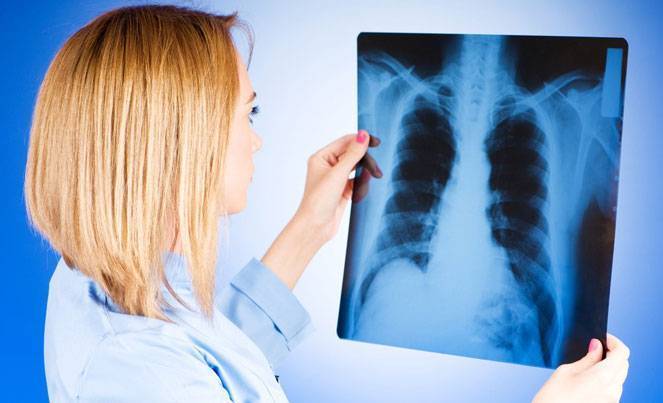 Рентген легких лучше или флюорография – как определить пневмонию