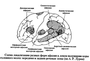 Характеристика афферентной моторной афазии