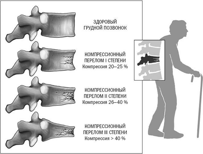 Мануальная терапия презентация