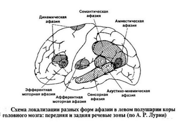 Коррекция моторной афазии