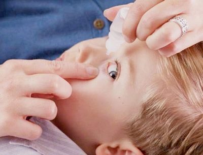 Сульфацил натрия глазные капли детям