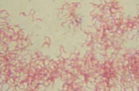 Klebsiella pneumoniae 10 5