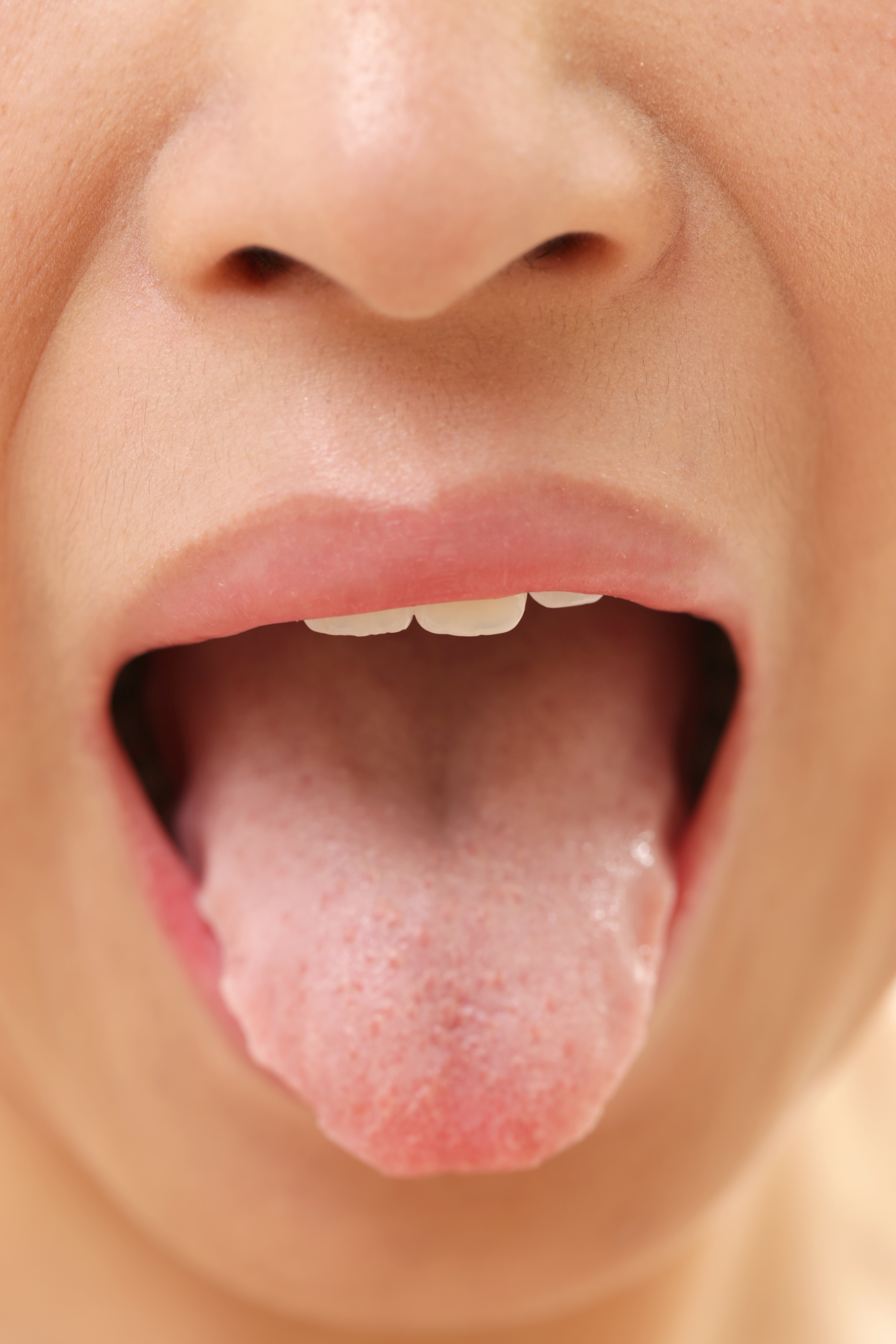 10 видов глоссита языка с фото, которые заставят насторожиться каждого
