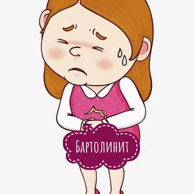 Бартолинит: симптомы у женщин и лечение, причины