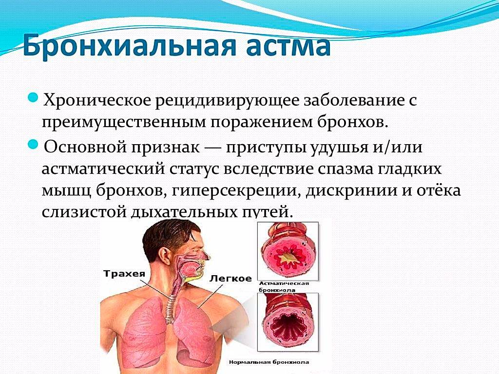 Приступ при бронхиальной астме