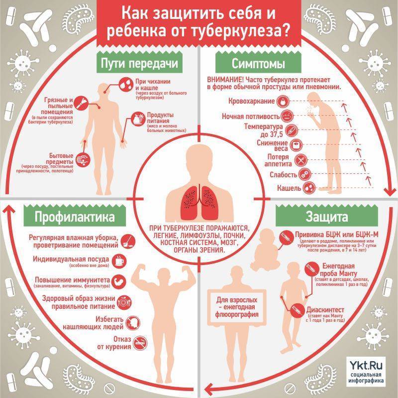 Туберкулез: симптомы и первые признаки в начальной стадии