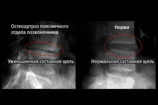 Как пройти полное обследование позвоночника