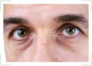 При каких заболеваниях желтеет кожа и белок глаз?