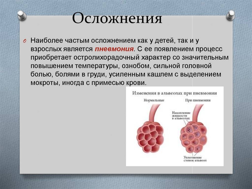 Наиболее частые осложнения. Парамиксовирус патогенез.