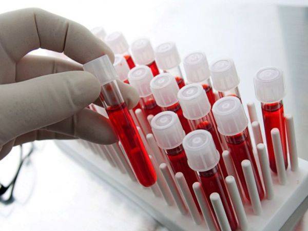 Диагностика туберкулеза: анализ крови, проба манту, диаскин тест и другие