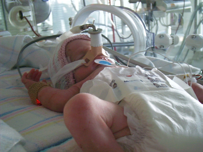 Недоношенный ребенок (33 фото): 7 и 8 месяцев, последствия в будущем