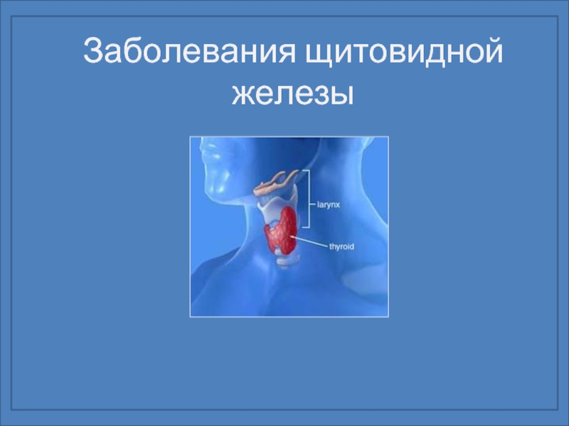 Щитовидная железа или расшатанные нервы?