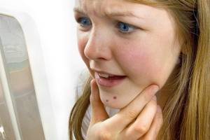 Сыпь на подбородке у женщин: причины и высыпания, способы лечения