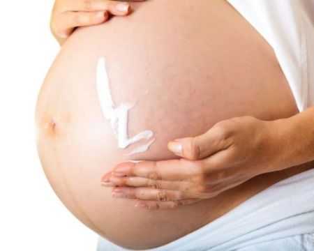 Растяжки при беременности: как выглядят, профилактика, как избавиться