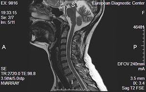 Что такое мрт шейного отдела позвоночника с контрастированием