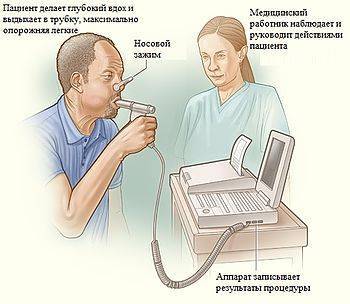 Проведение спирометрии при бронхиальной астме и расшифровка результатов