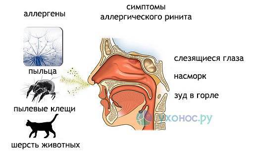 Прозрачные сопли у взрослого без температуры текут ручьем чем лечить
