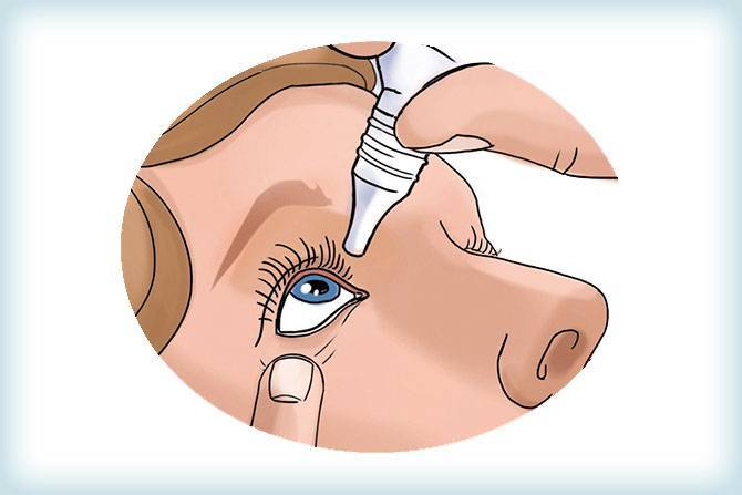 Как вести себя после операции по удалению катаракты глаза (замене хрусталика на иол)