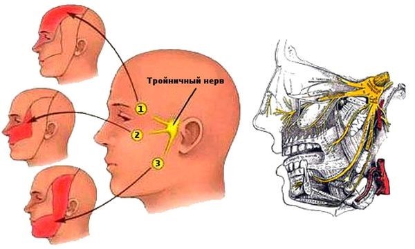 Симптомы и лечение невралгии тройничного лицевого нерва - диагностика и медикаментозные препараты