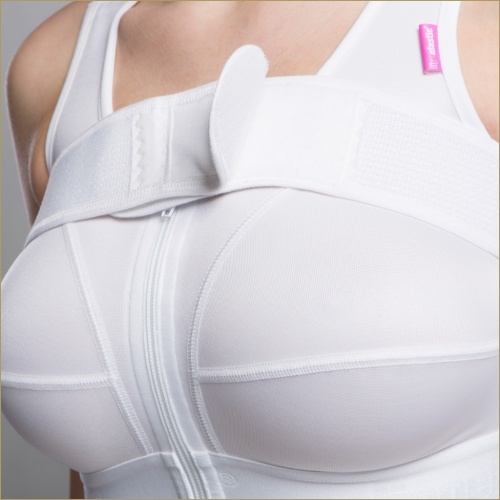 Маммопластика: топ-10 главных вопросов о пластике груди