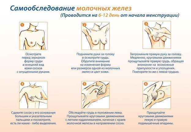 Сыпь под грудью, зуд и красные пятна у женщины: фото, причины, симптомы и лечение