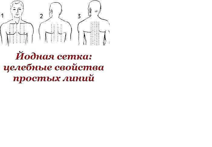 Йодовая сетка при кашле взрослому как рисовать