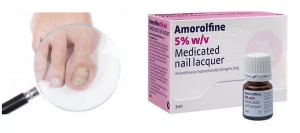 Аморолфин для лечения грибка ногтей