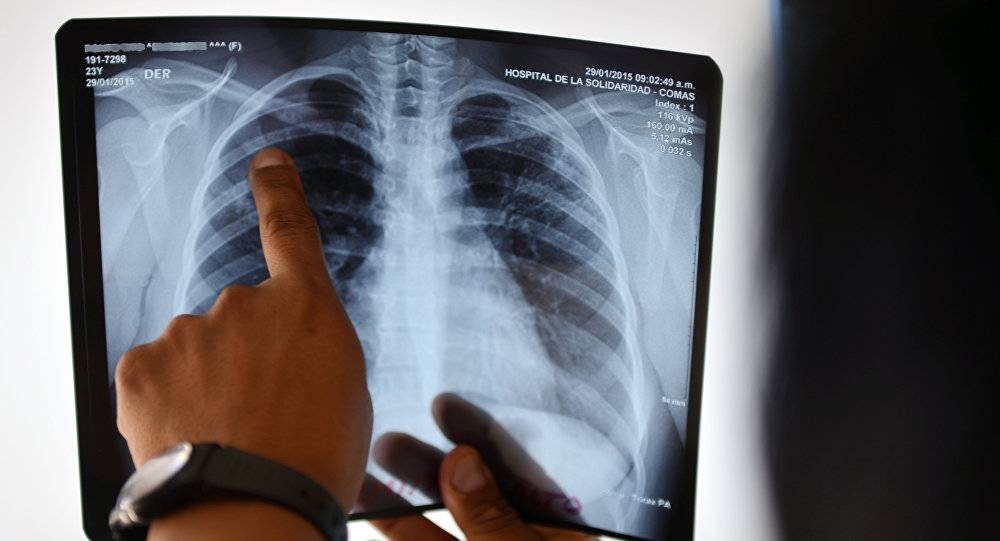 Сколько лечат туберкулез в стационаре и амбулаторно