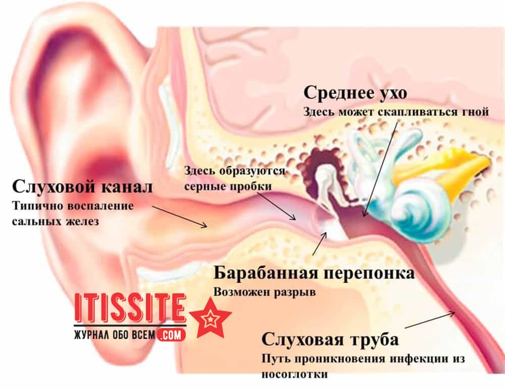 Причины и диагностика свиста в ушах