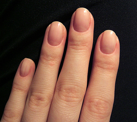 Сухие, тонкие, ломкие ногти на руках: причины и лечение, что делать