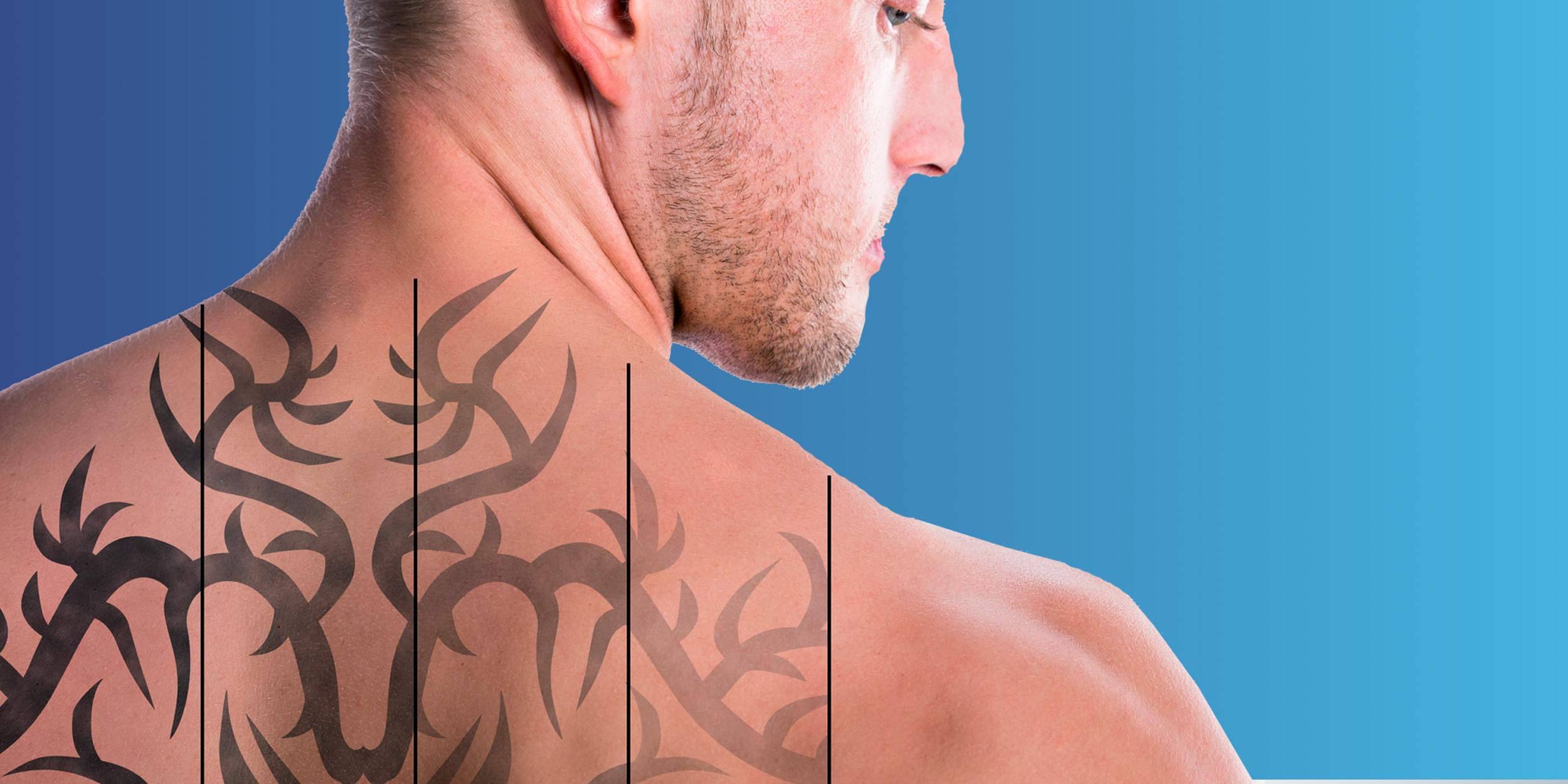 Воздействие татуировок на организм человека: «бить» или «не бить» – вот в чём вопрос