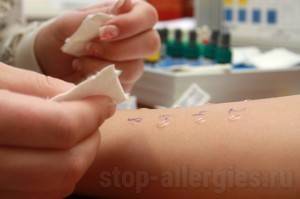 Как берут пробы на аллергены: разновидности кожных тестов, особенности проведения и результаты