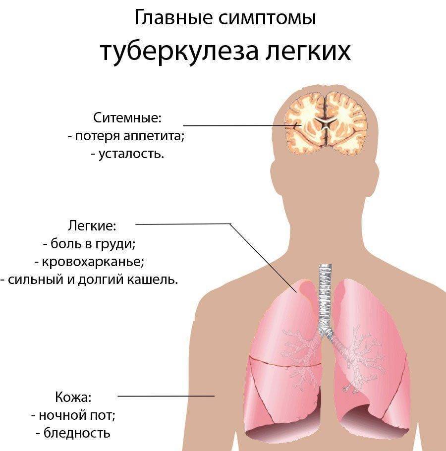 Клинические проявления заболевания туберкулеза