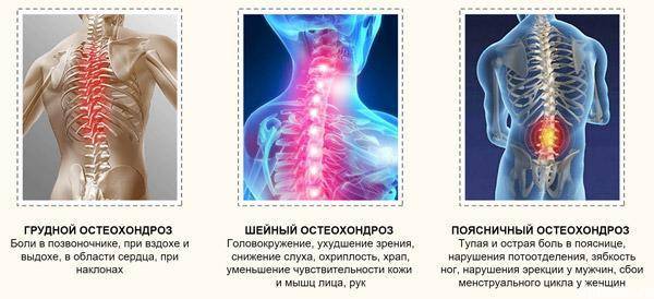 Как стираются диски в позвоночнике