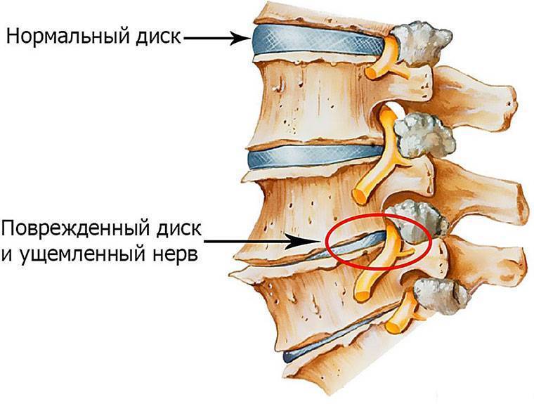 Болит поясница после сна: подробное описание причин