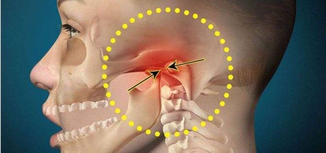 Боль в горле при глотании без температуры — острая, сильная, режущая, с одной стороны, если отдает в ухо. лечение в домашних условиях