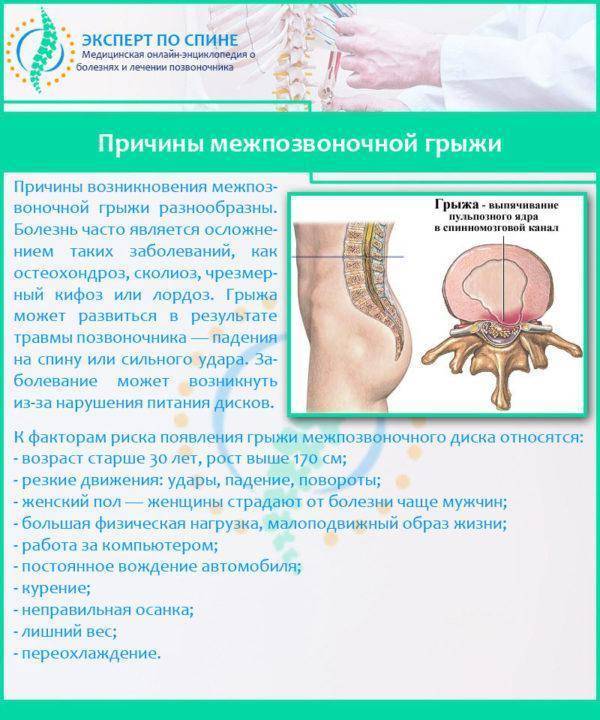 Карипазим при грыже позвоночника отзывы цены