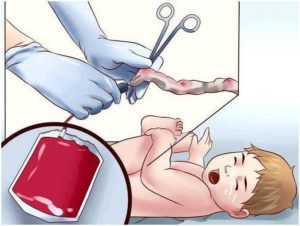 Что делать, если у грудничка идет кровь из пупка