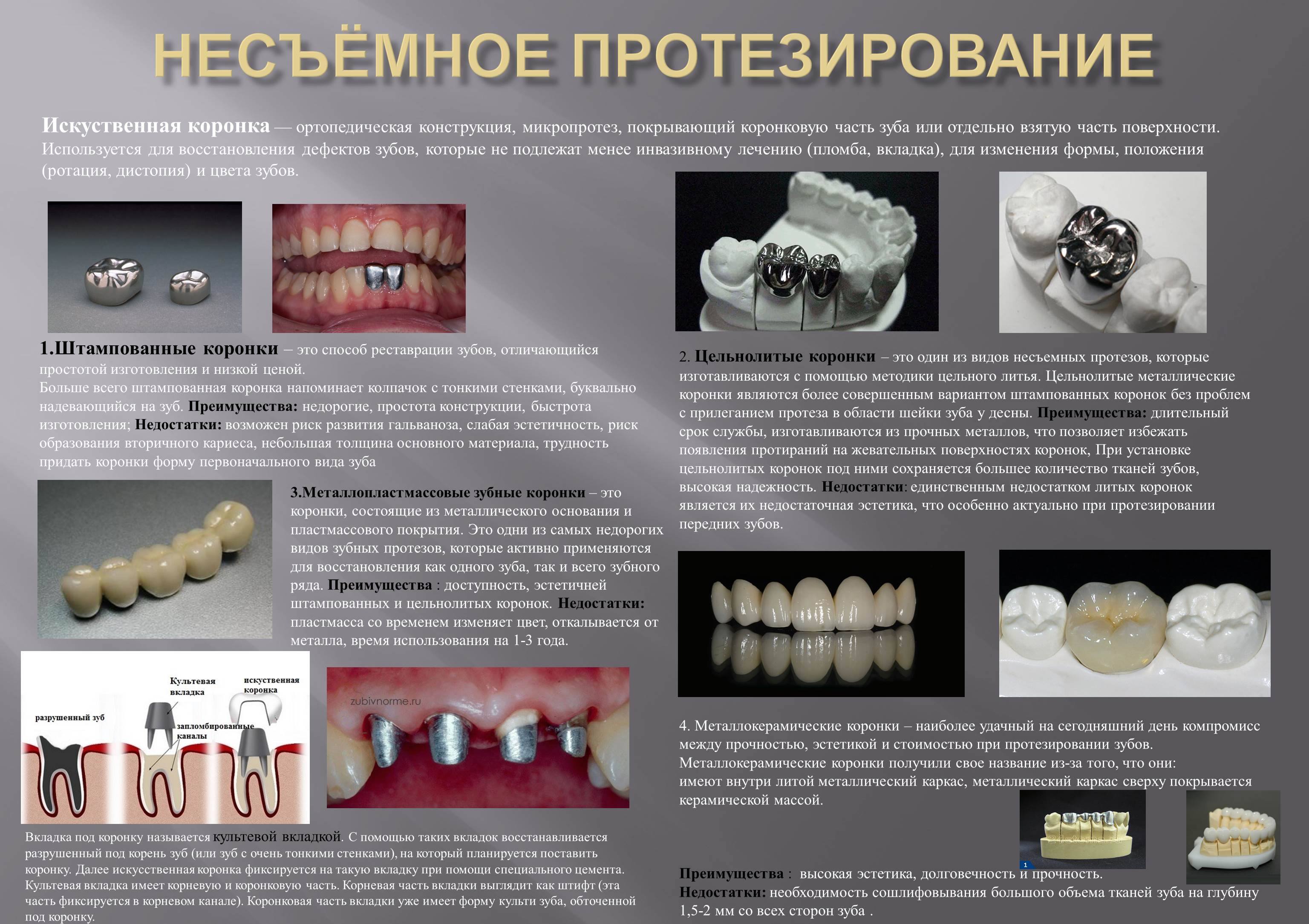 Какую функцию выполняет коронка зуба. Коронка штампованная стальная восстановительная. Фиксация штампованнокоронки. Металлокерамика коронки на жевательные зубы. Мостовидный протез металлокерамика.