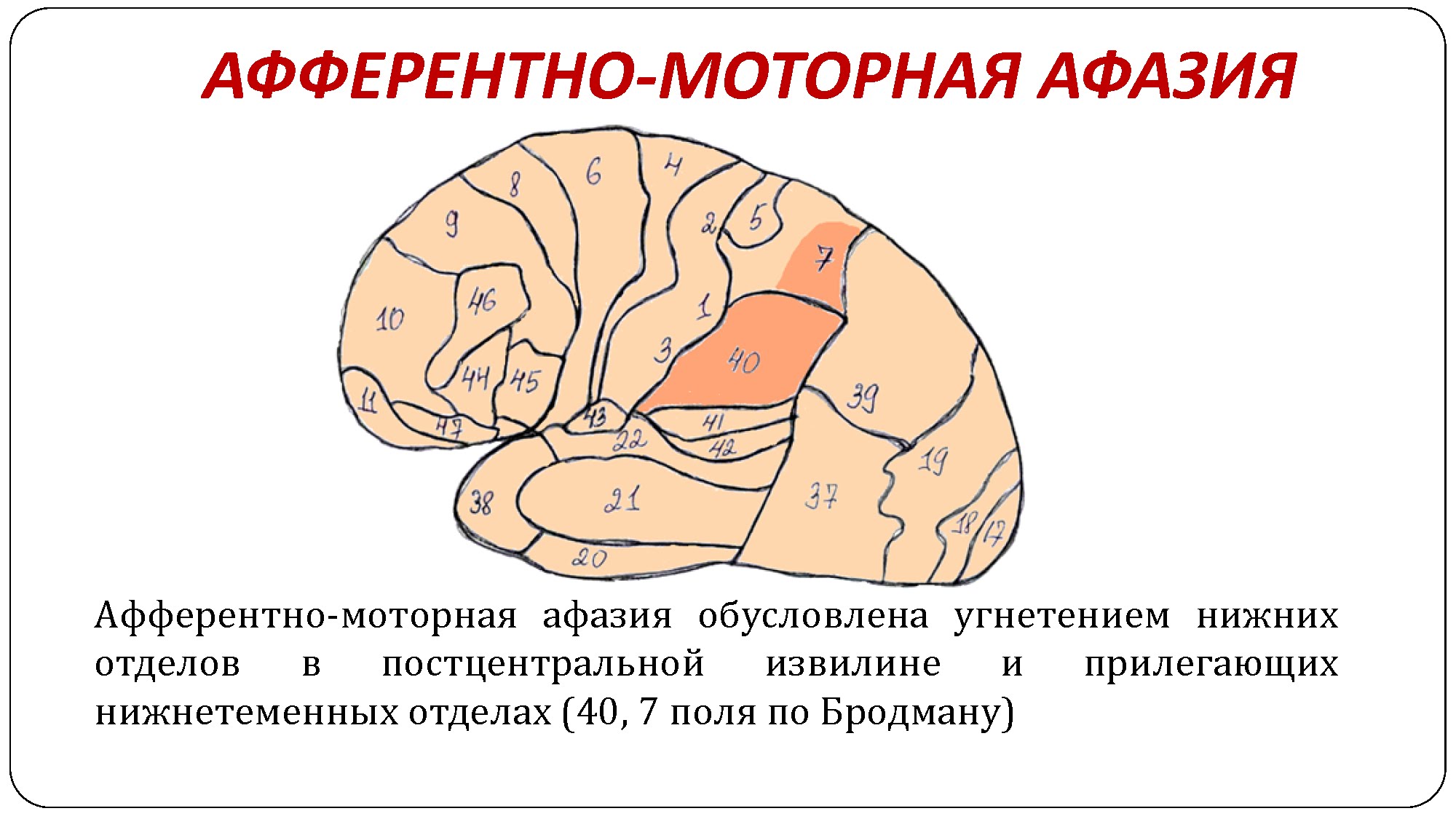 Афферентная моторная афазия нарушения. Локализация поражения при эфферентной моторной афазии. Поражения при афферентной моторной афазии. Афферентная моторная афазия очаг поражения. Очаг поражения при моторной афазии.