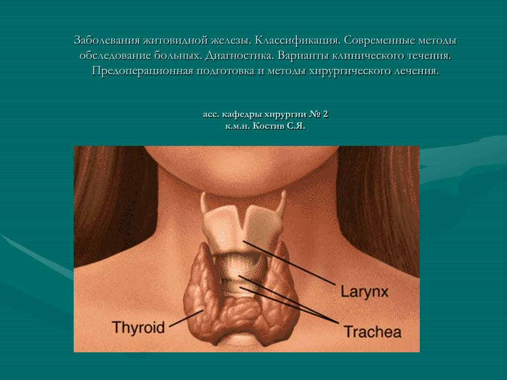 Щитовидная железа и психоз: железа, последствия, признаки, причины, проявления, психоз, щитовидная