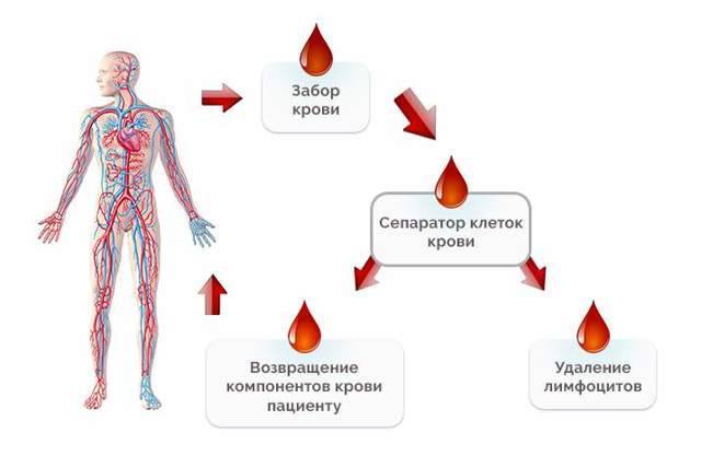 Аллергический кашель ночью у взрослого что делать. 92d9b276761bf3f34afc1d7e17639542. Аллергический кашель ночью у взрослого что делать фото. Аллергический кашель ночью у взрослого что делать-92d9b276761bf3f34afc1d7e17639542. картинка Аллергический кашель ночью у взрослого что делать. картинка 92d9b276761bf3f34afc1d7e17639542