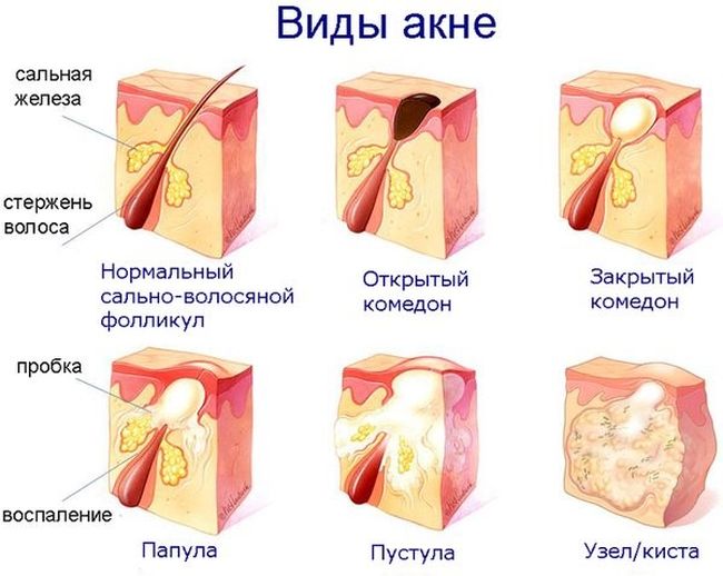 Зеркалин: инструкция по применению, аналоги, цена, отзывы