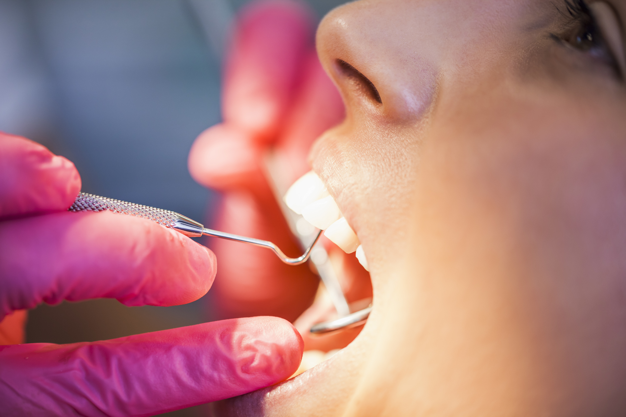 Восстановление эмали зубов: методы восстановления зубной эмали