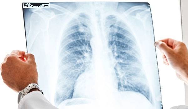 Результаты спирографии при бронхиальной астме и норма