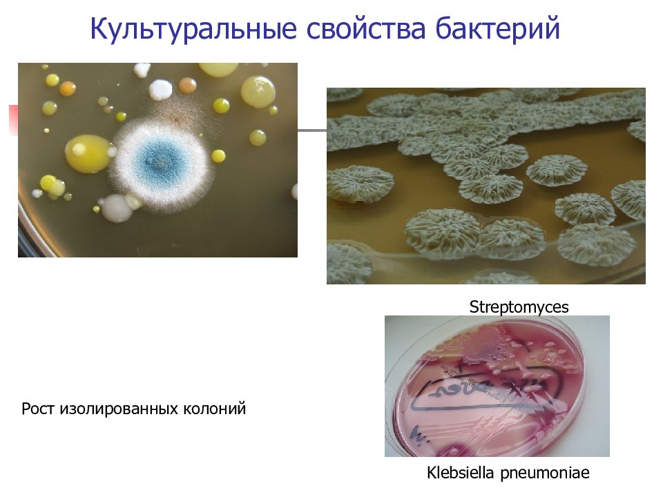 Оценка каких свойств микроорганизмов показана на рисунке